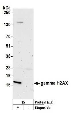 Western Blot Detection of Histone H2AX in EPE Treated HeLa Cells